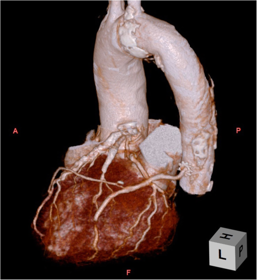 Fig. 4