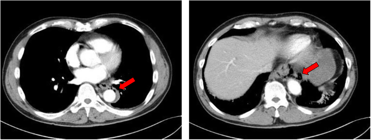 Fig. 1