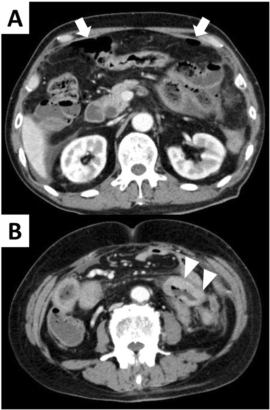 Fig. 1