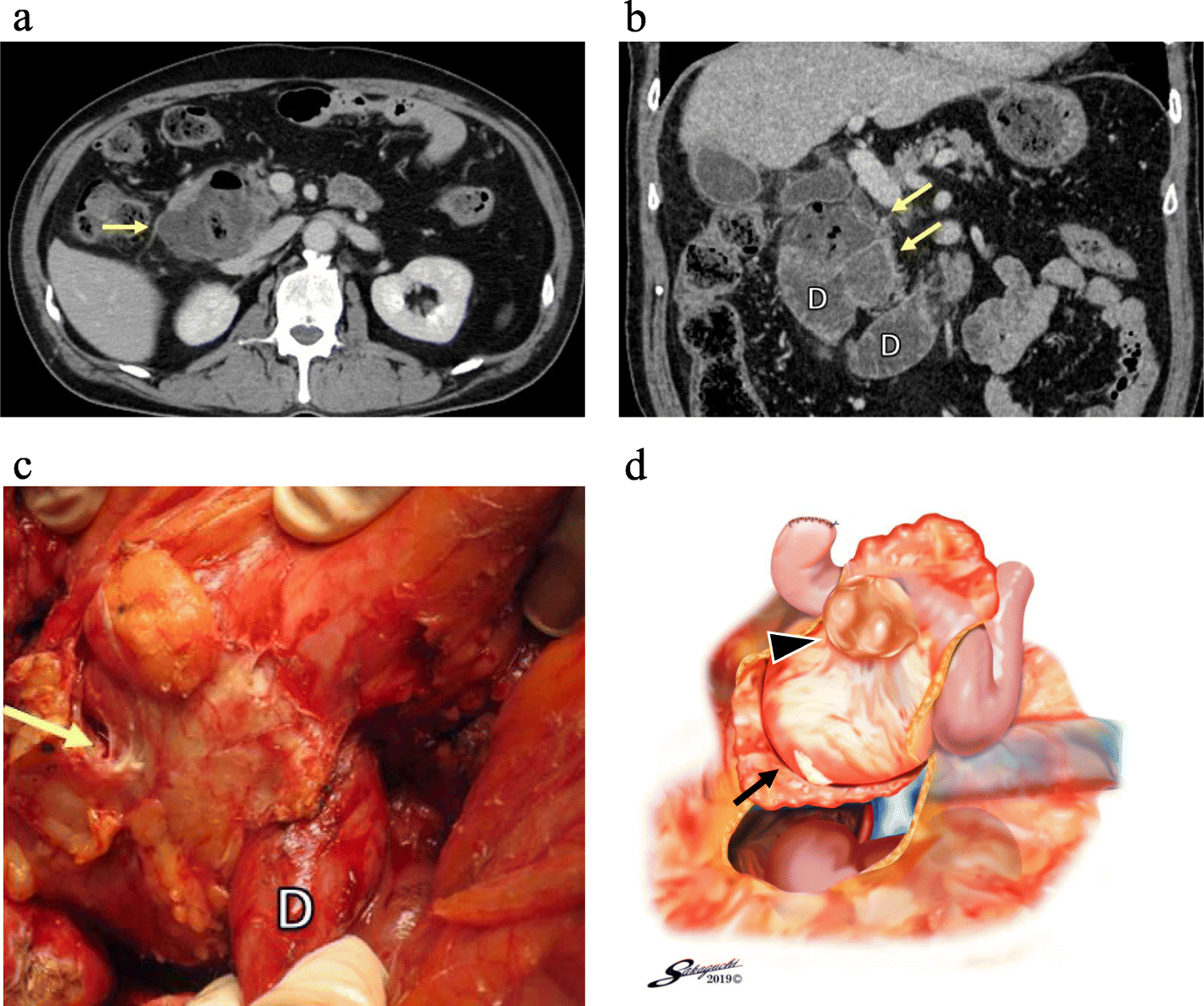 Fig. 2