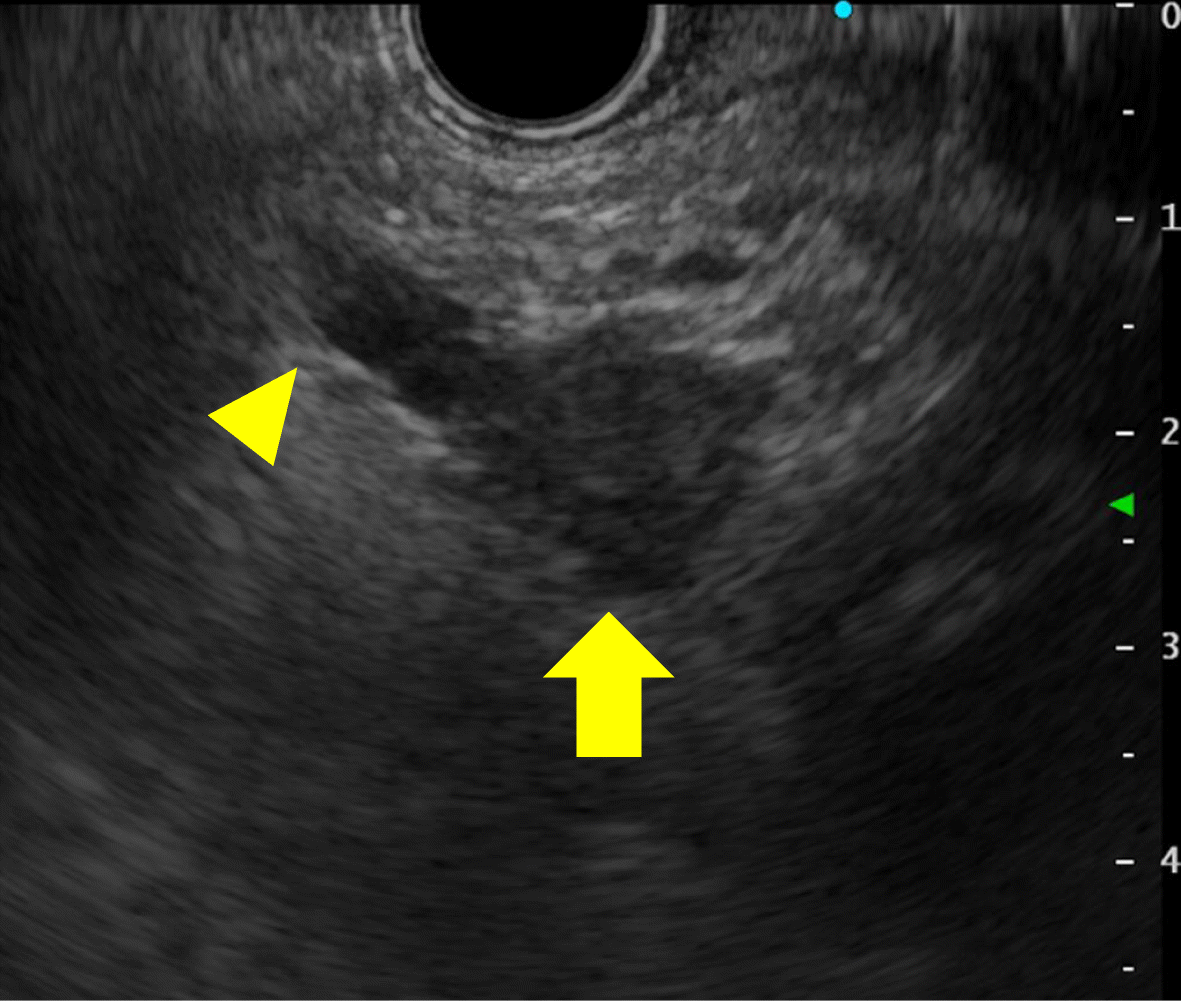 Fig. 5