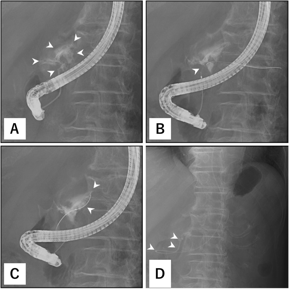 Fig. 2