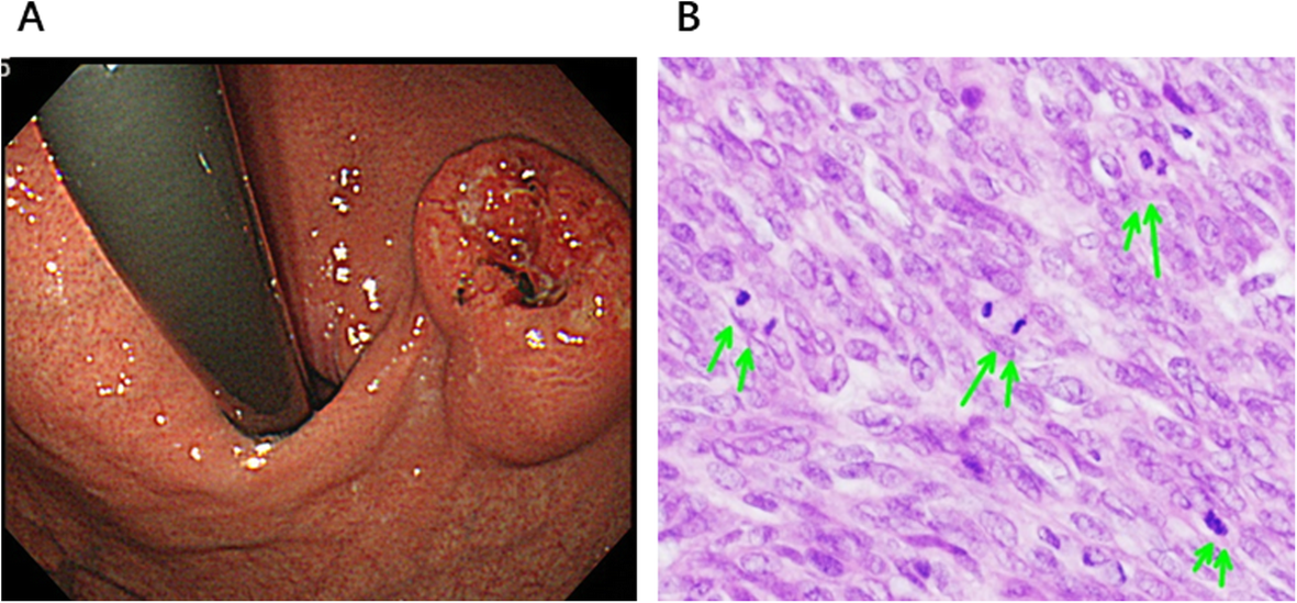 Fig. 1