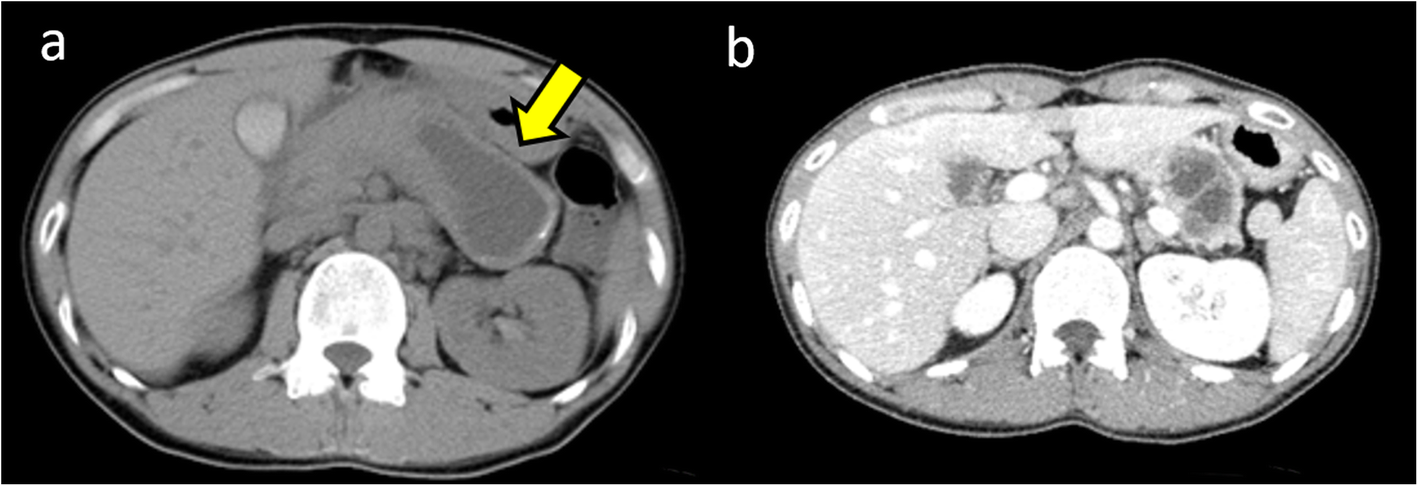 Fig. 1