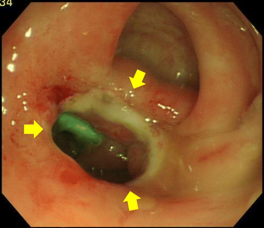 Fig. 5