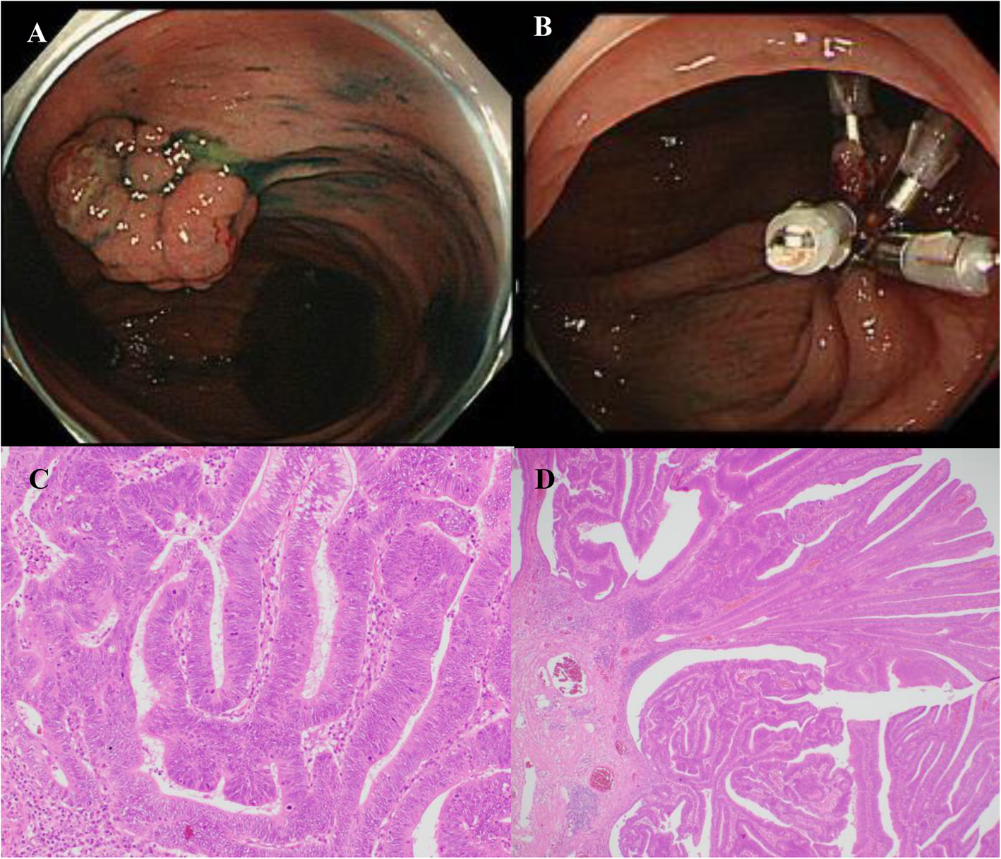 Fig. 1