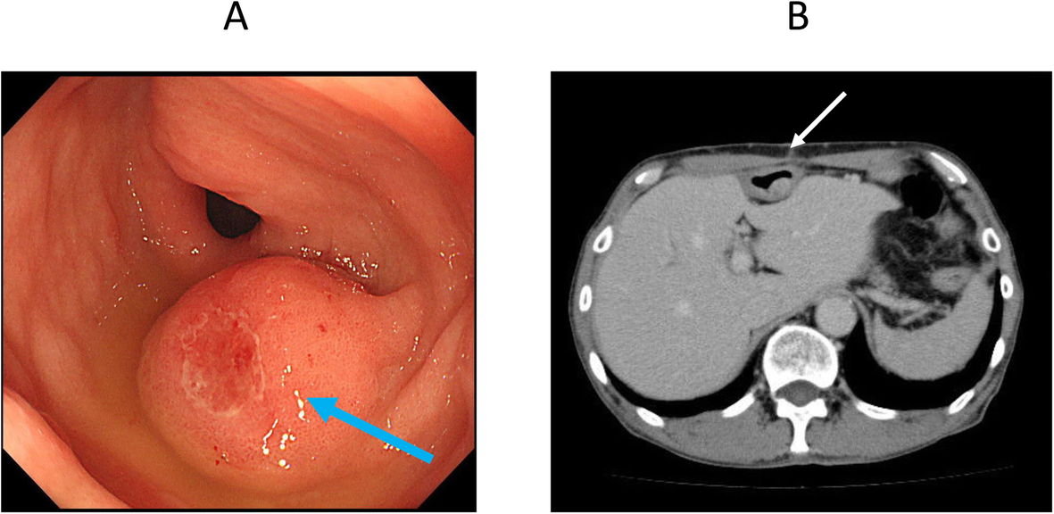 Fig. 1