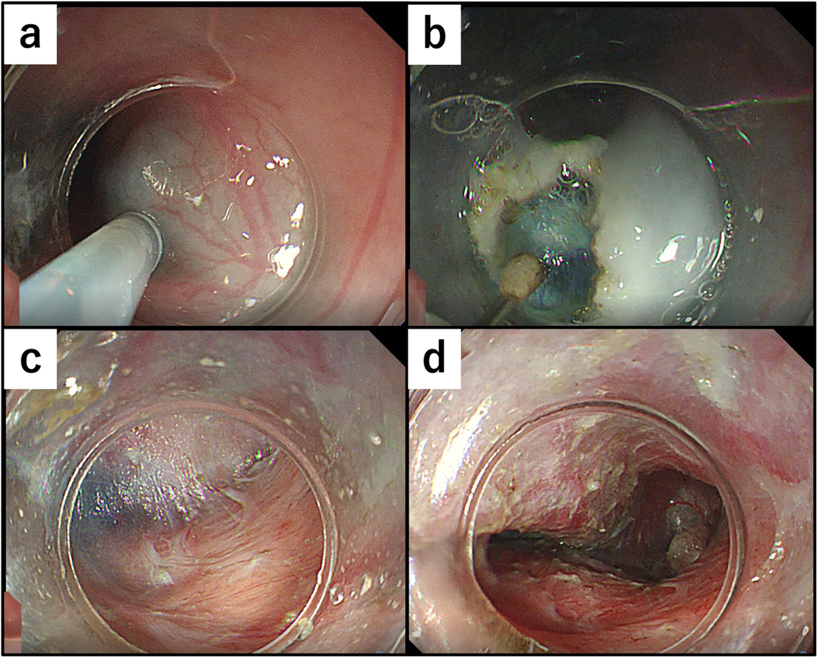 Fig. 4