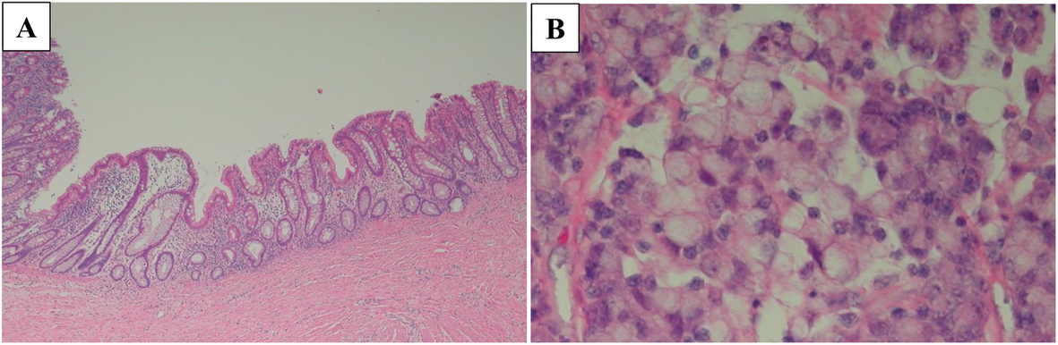 Fig.4 