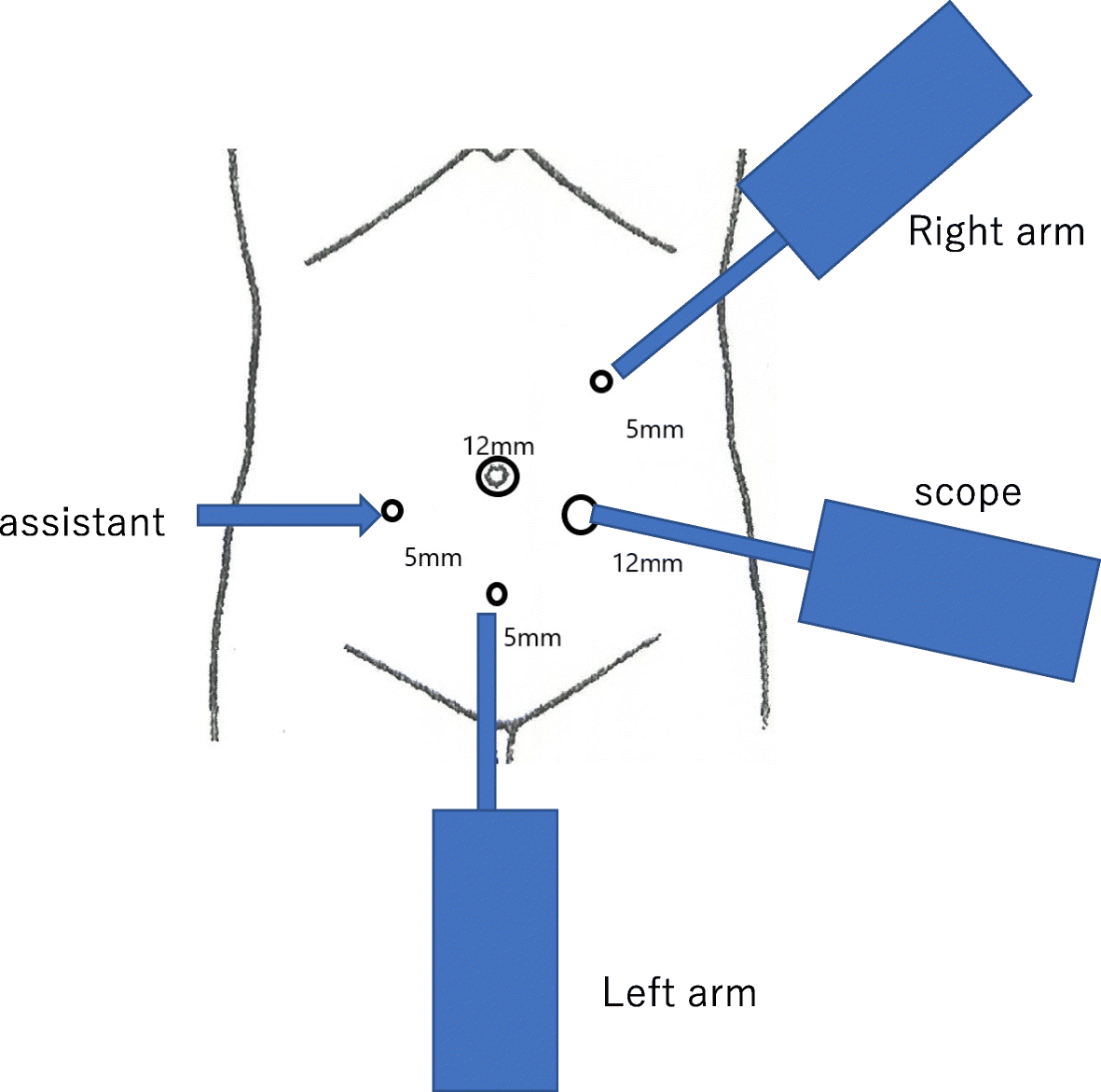 Fig. 2