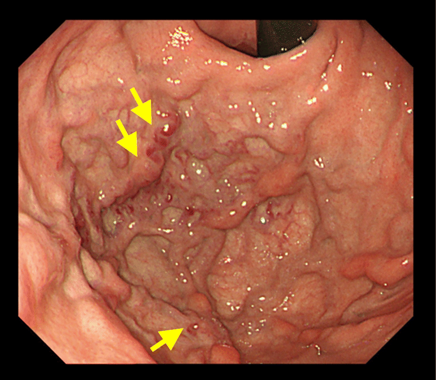 Fig. 1