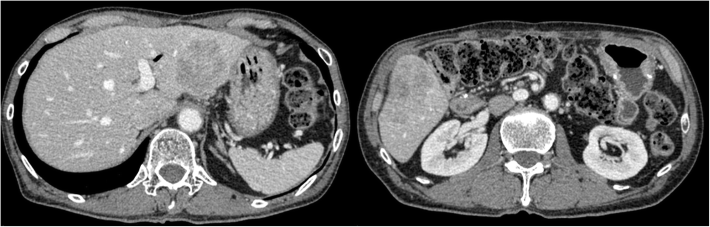 Fig. 7