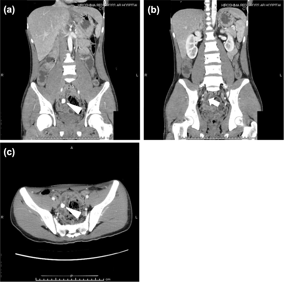 Fig. 2