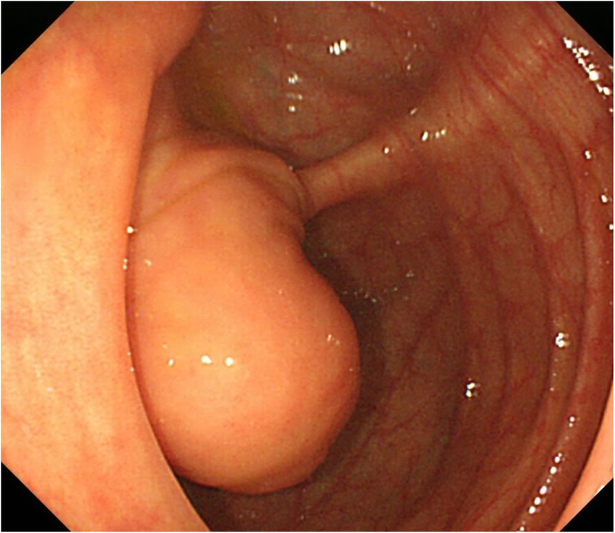 Fig. 2