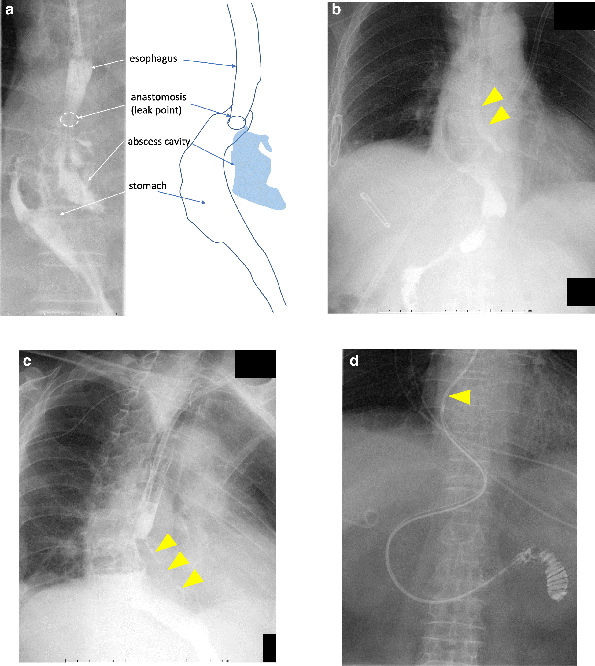 Fig. 3