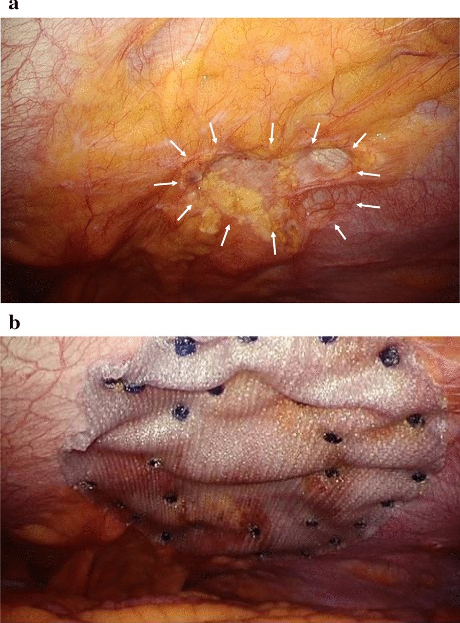 Fig. 6