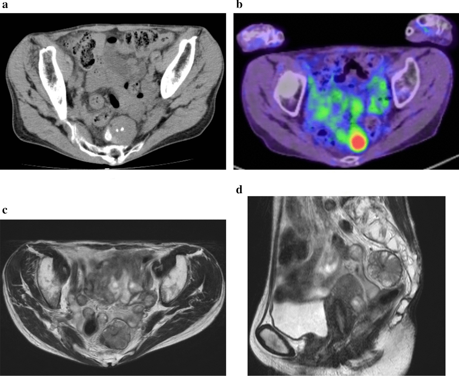 Fig. 1