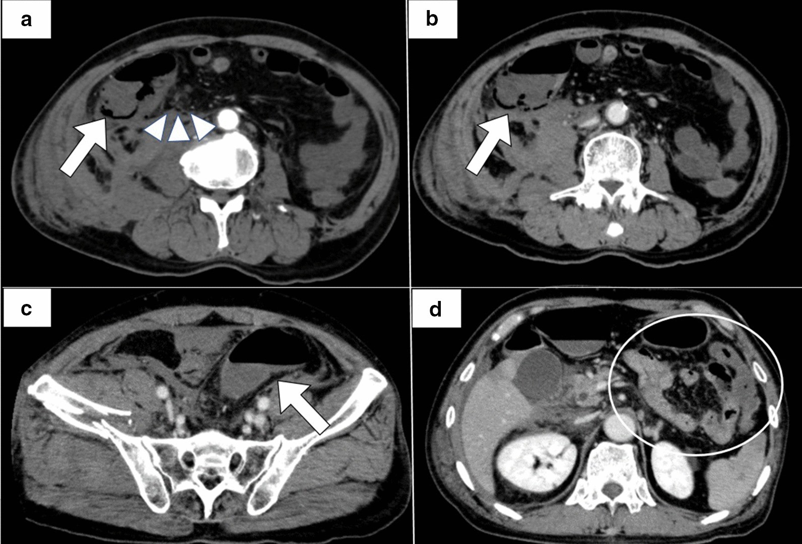 Fig. 2