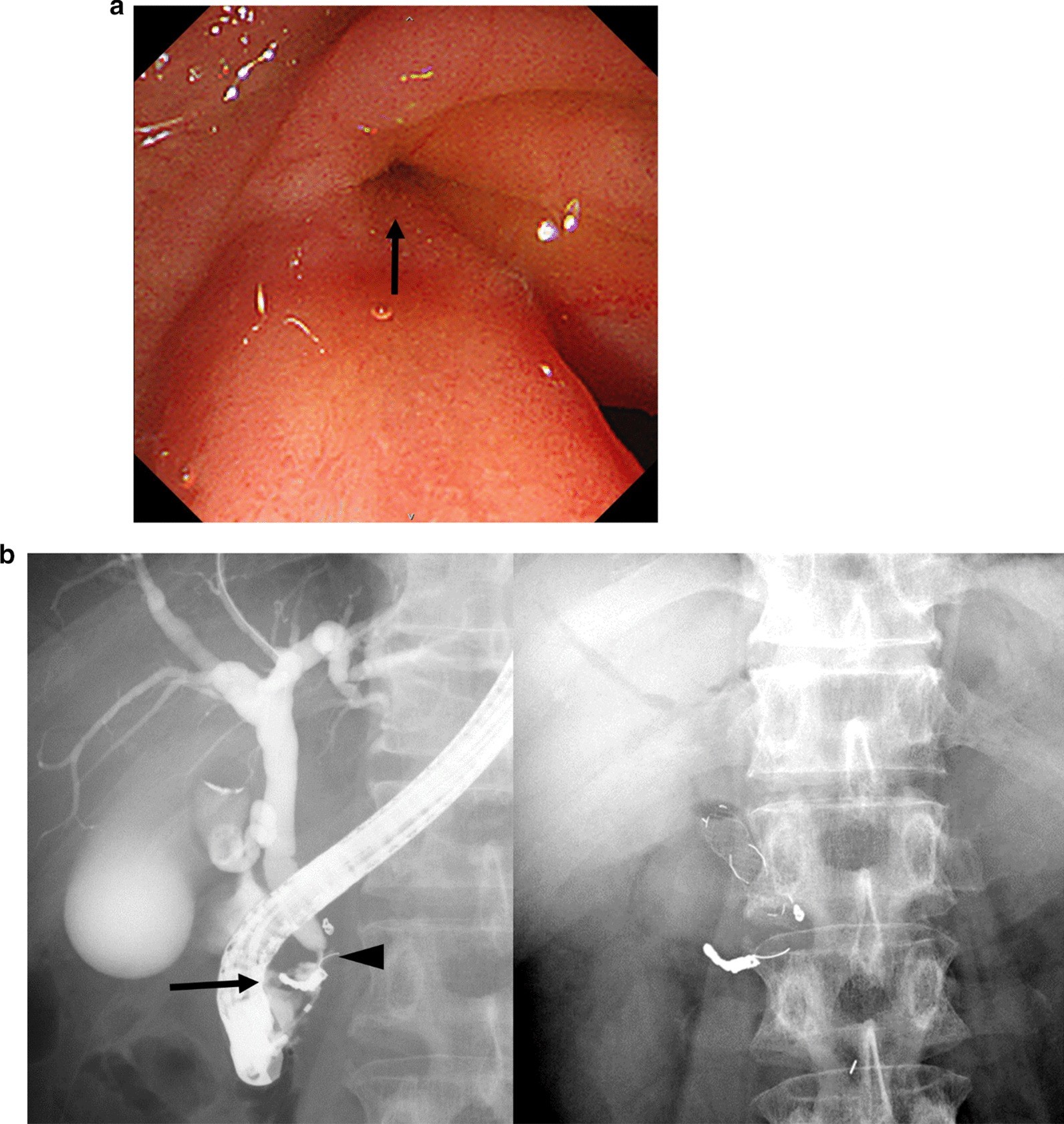 Fig. 6