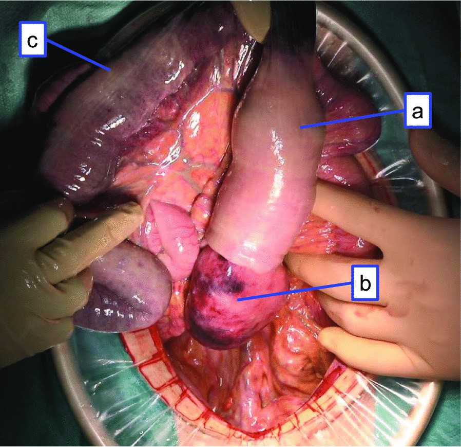 Fig. 2