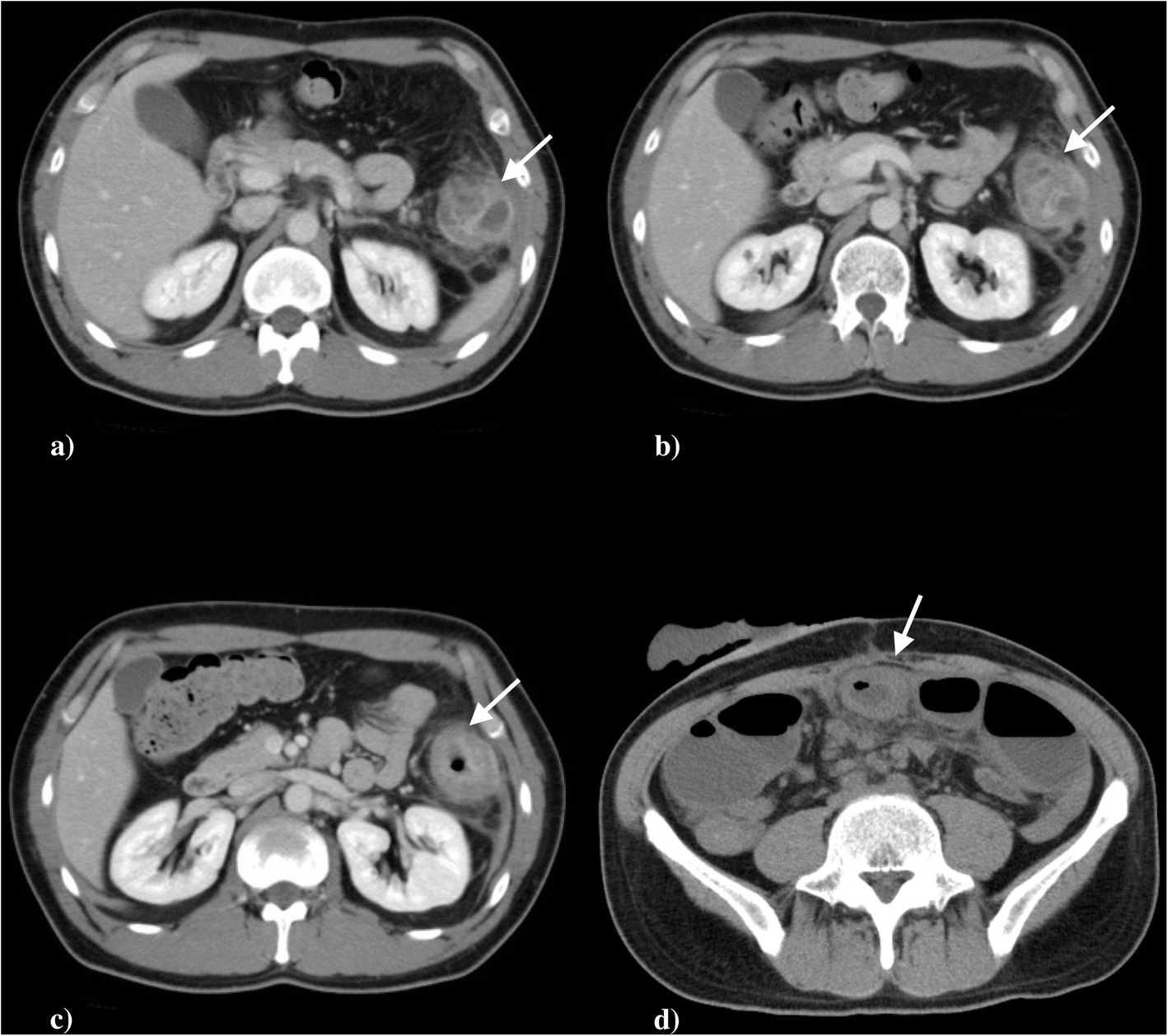 Fig. 1