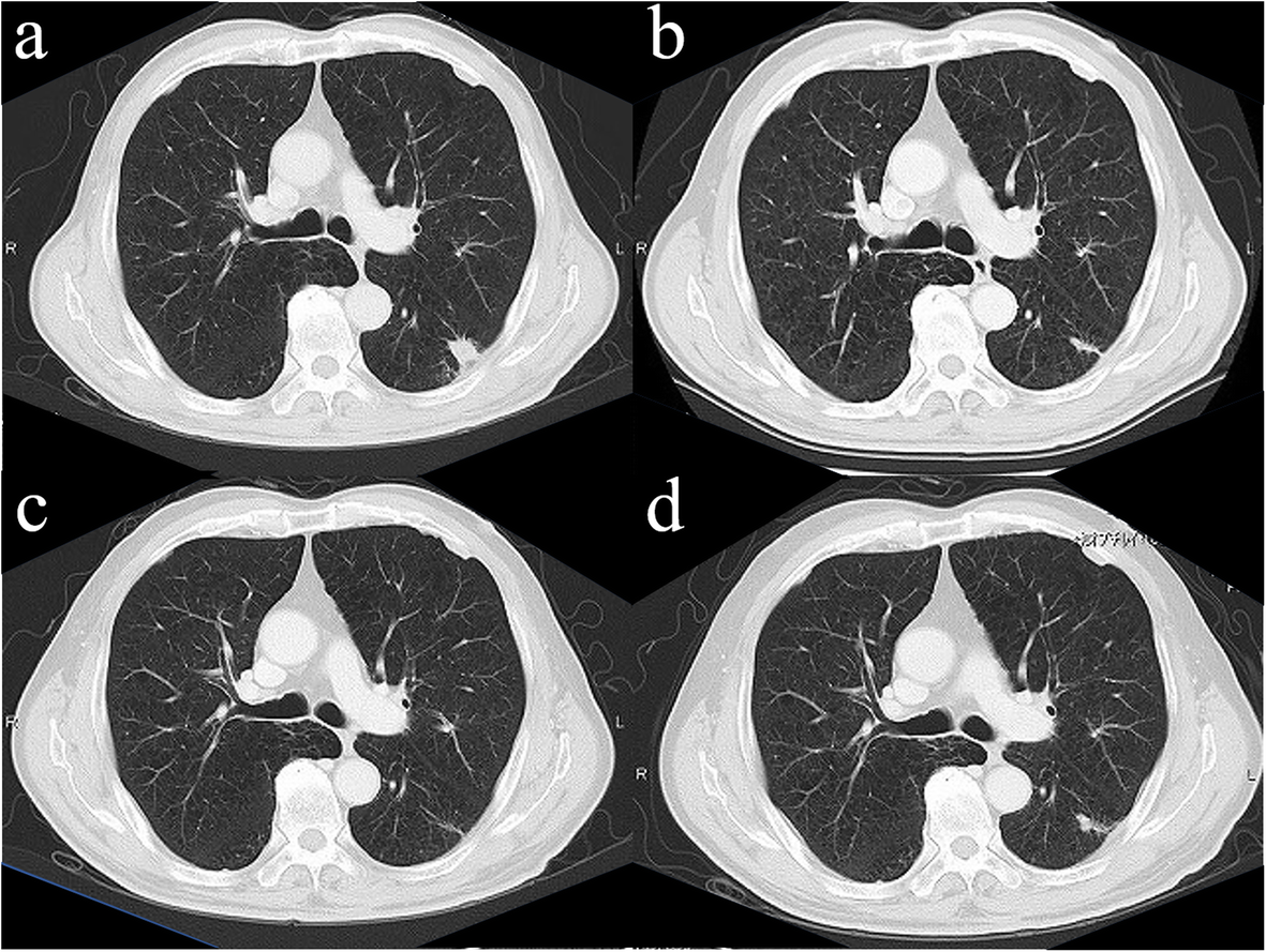 Fig. 1