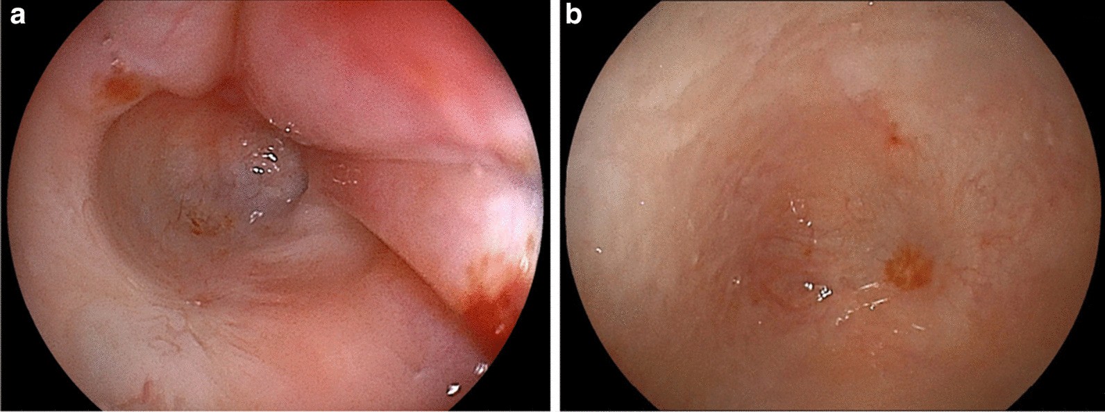 Fig. 5