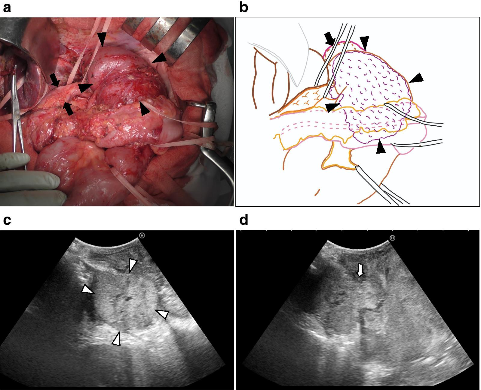 Fig.2