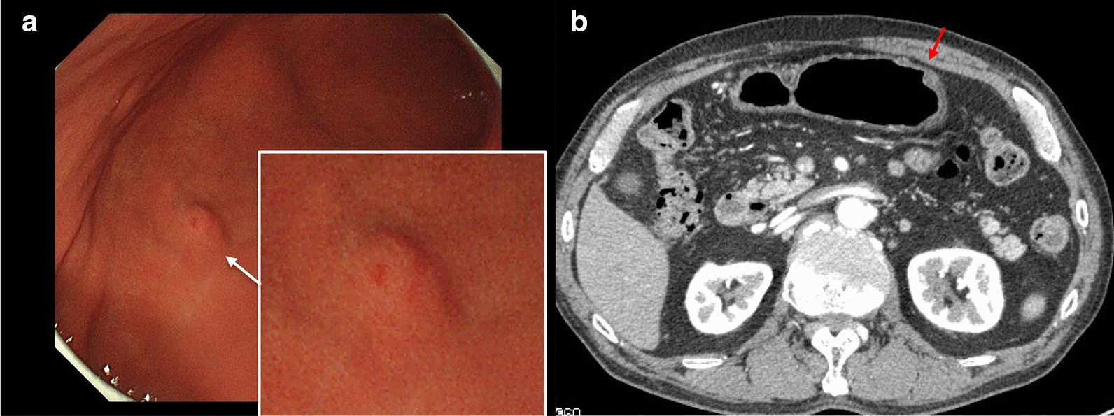 Fig. 1