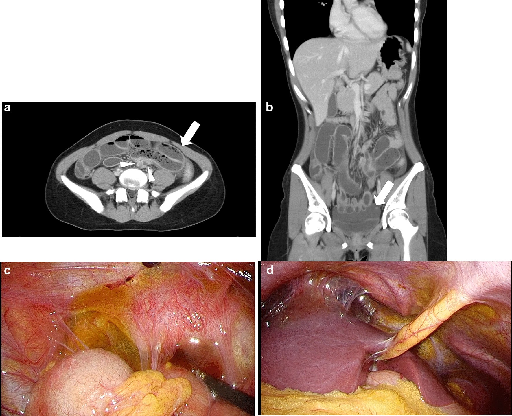 Fig. 1