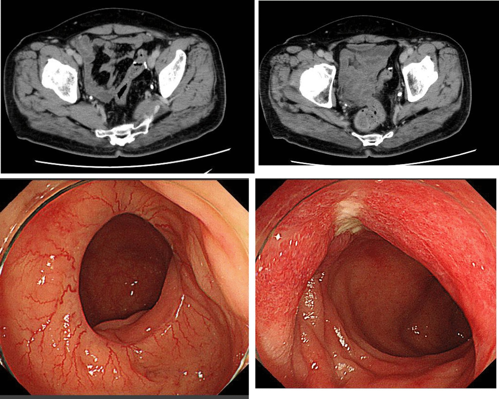 Fig. 6