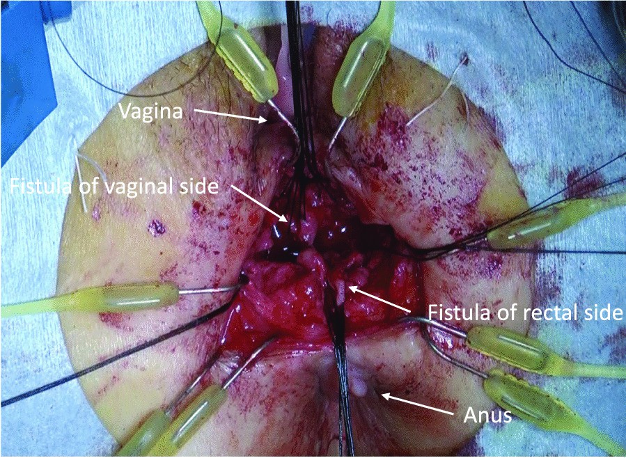 Fig. 3