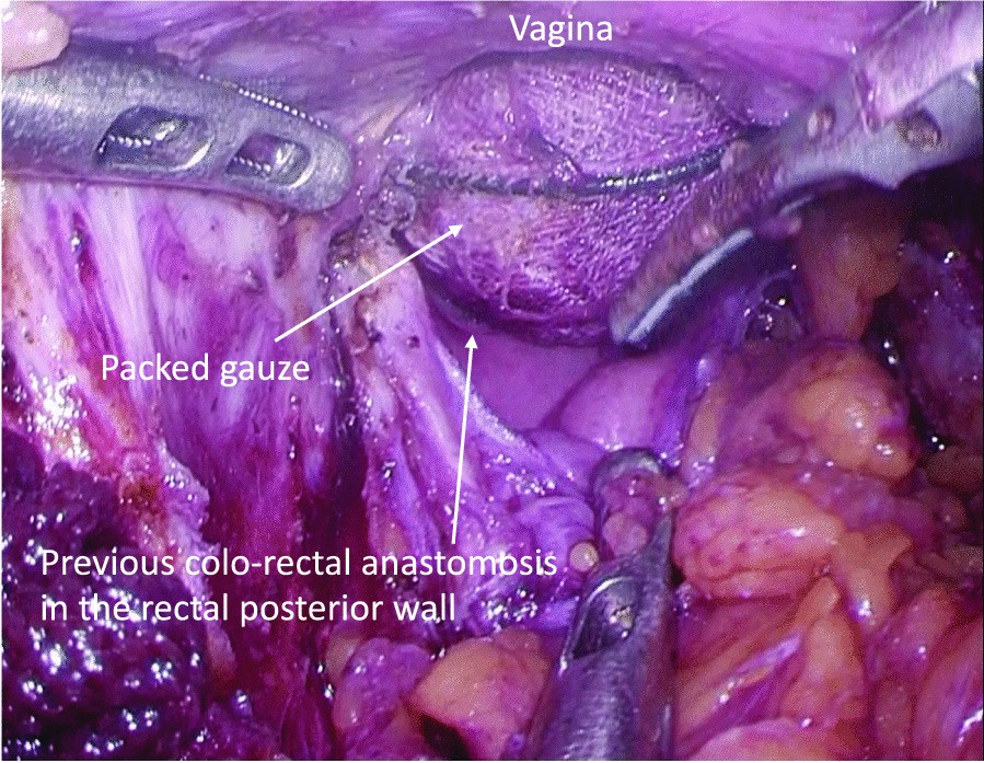 Fig. 4