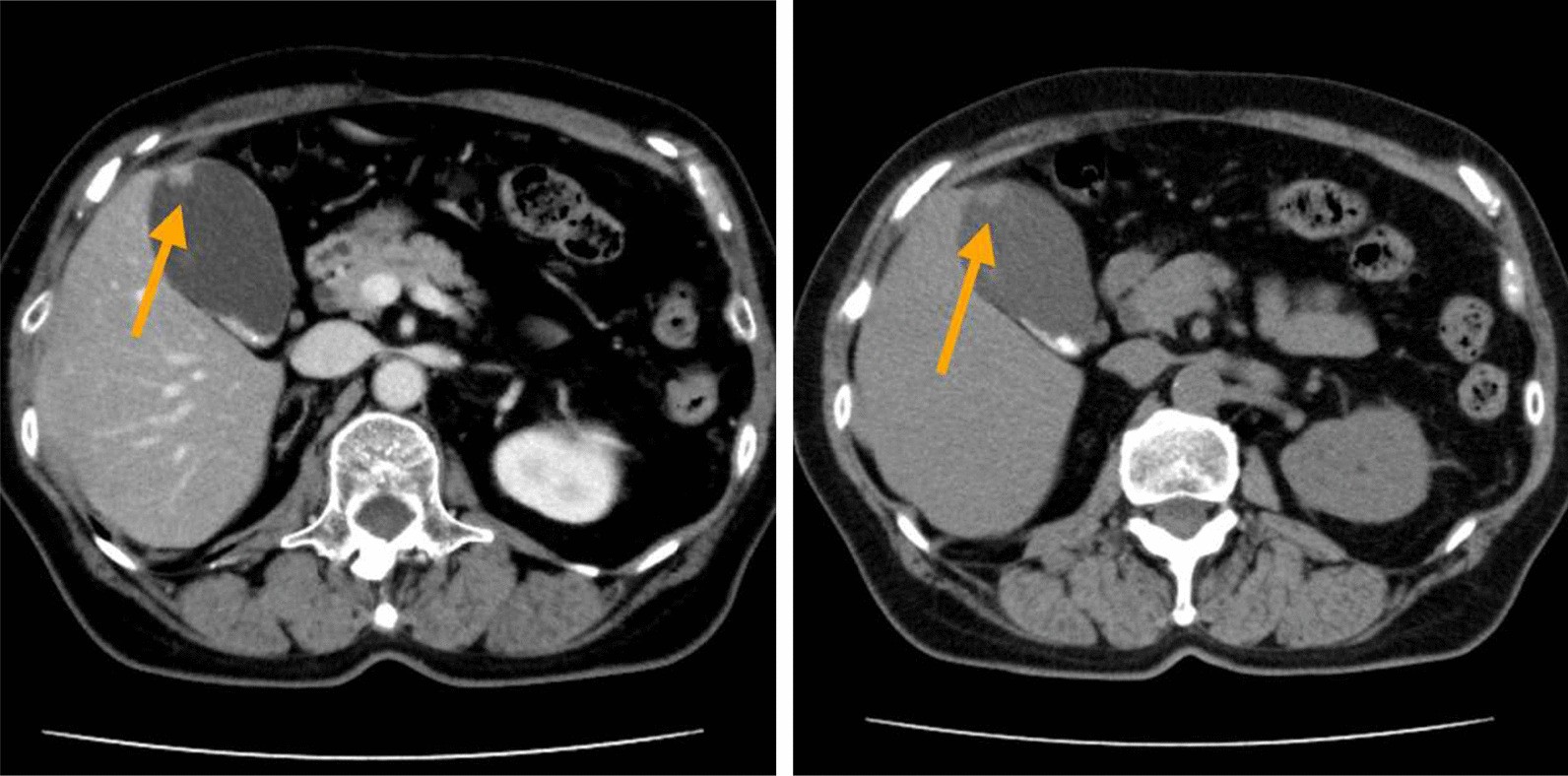 Fig.1