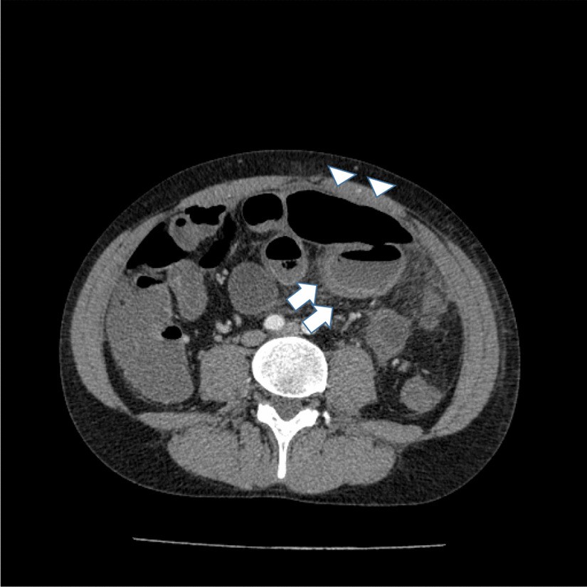 Fig. 1