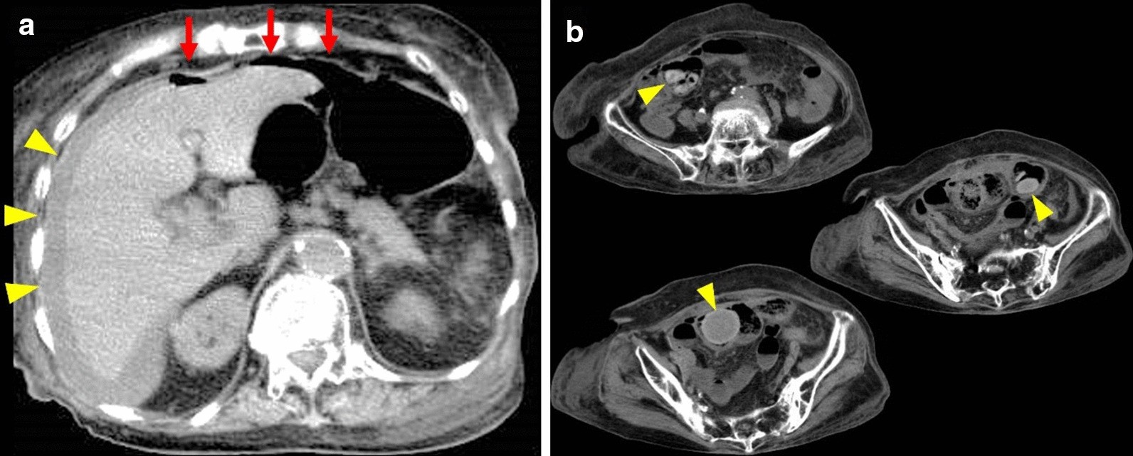 Fig. 1