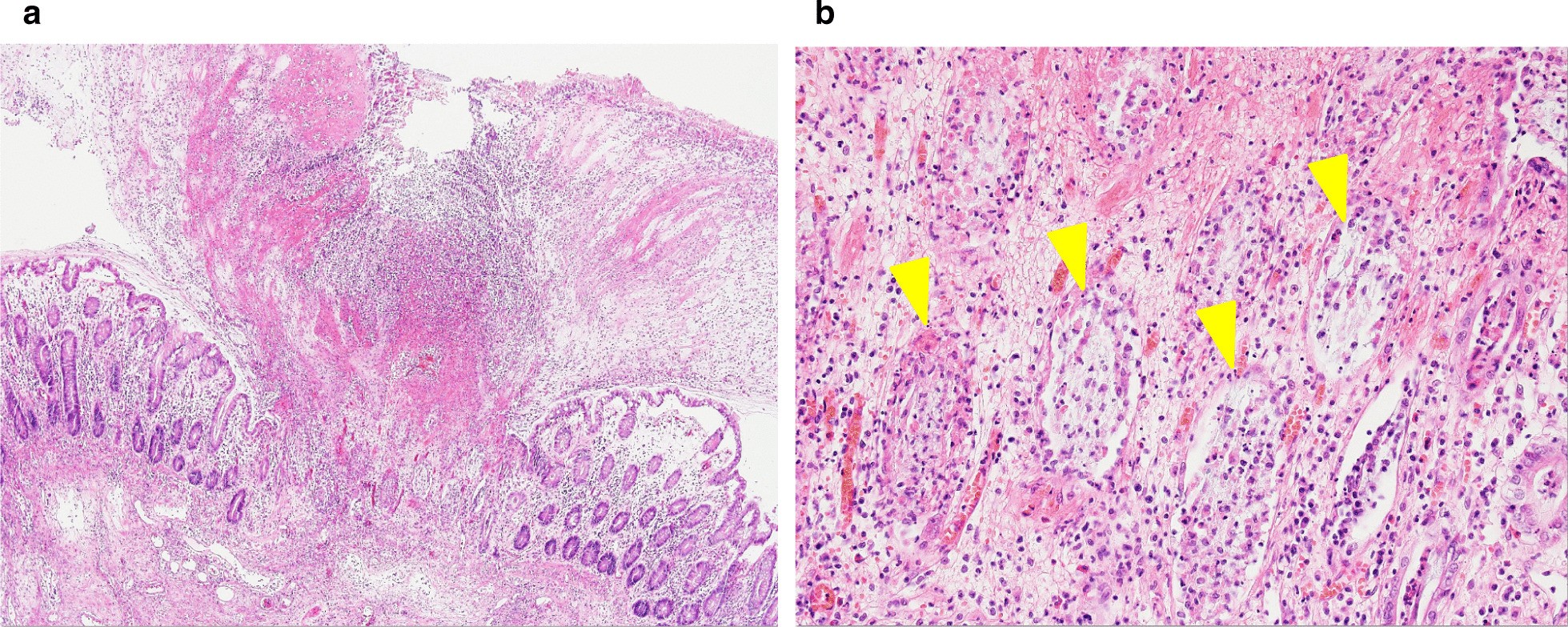 Fig. 4