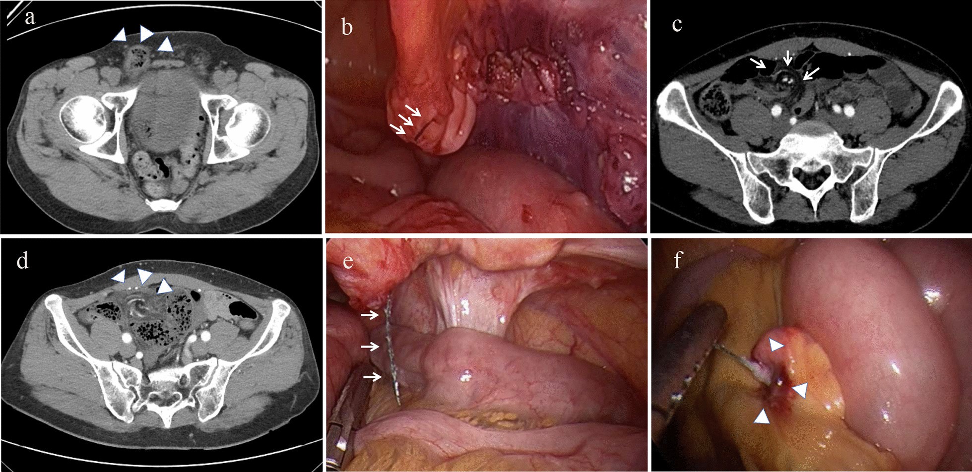 Fig. 1