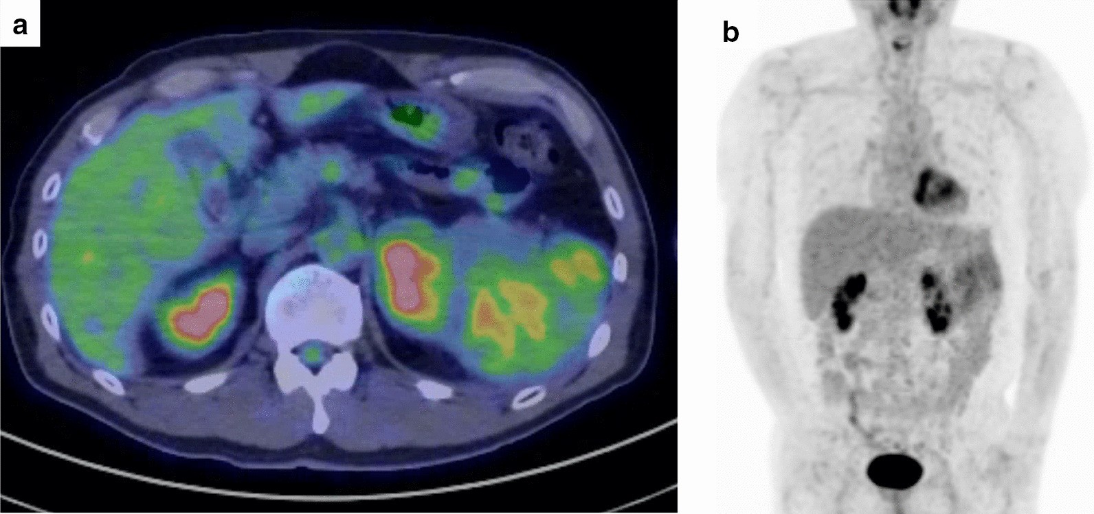 Fig. 2