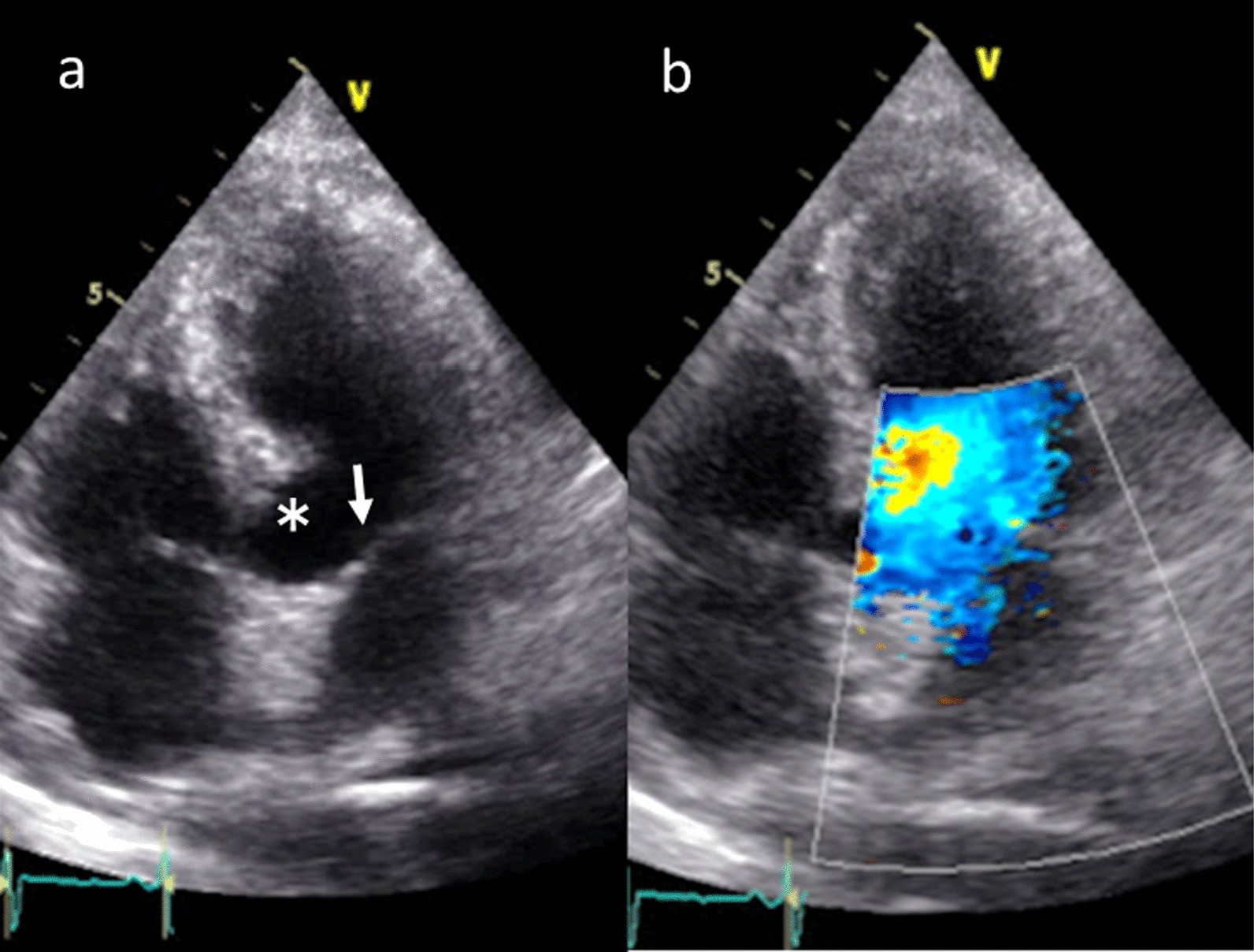 Fig. 4