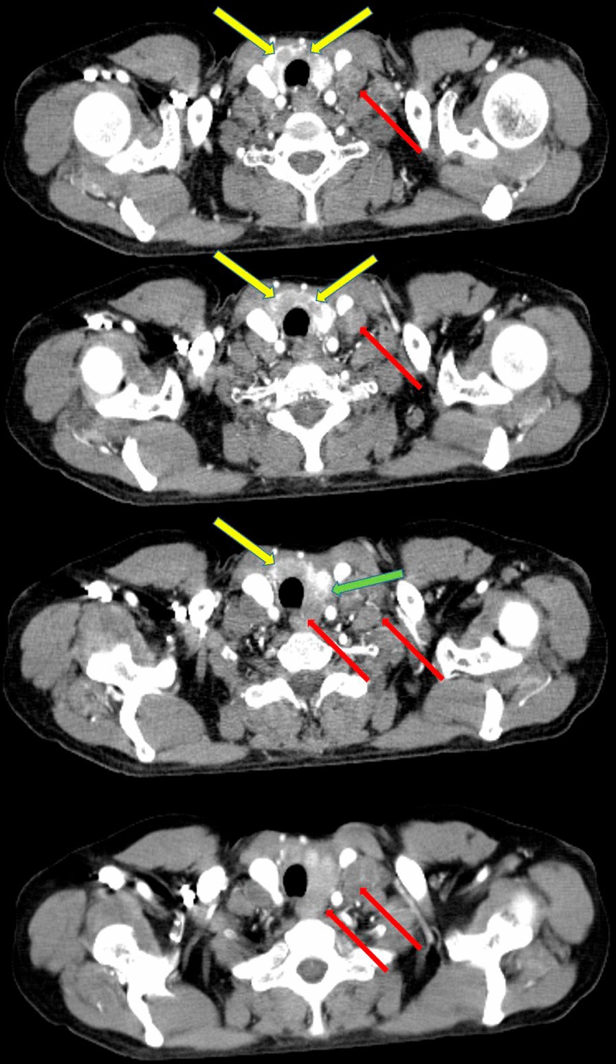 Fig. 2