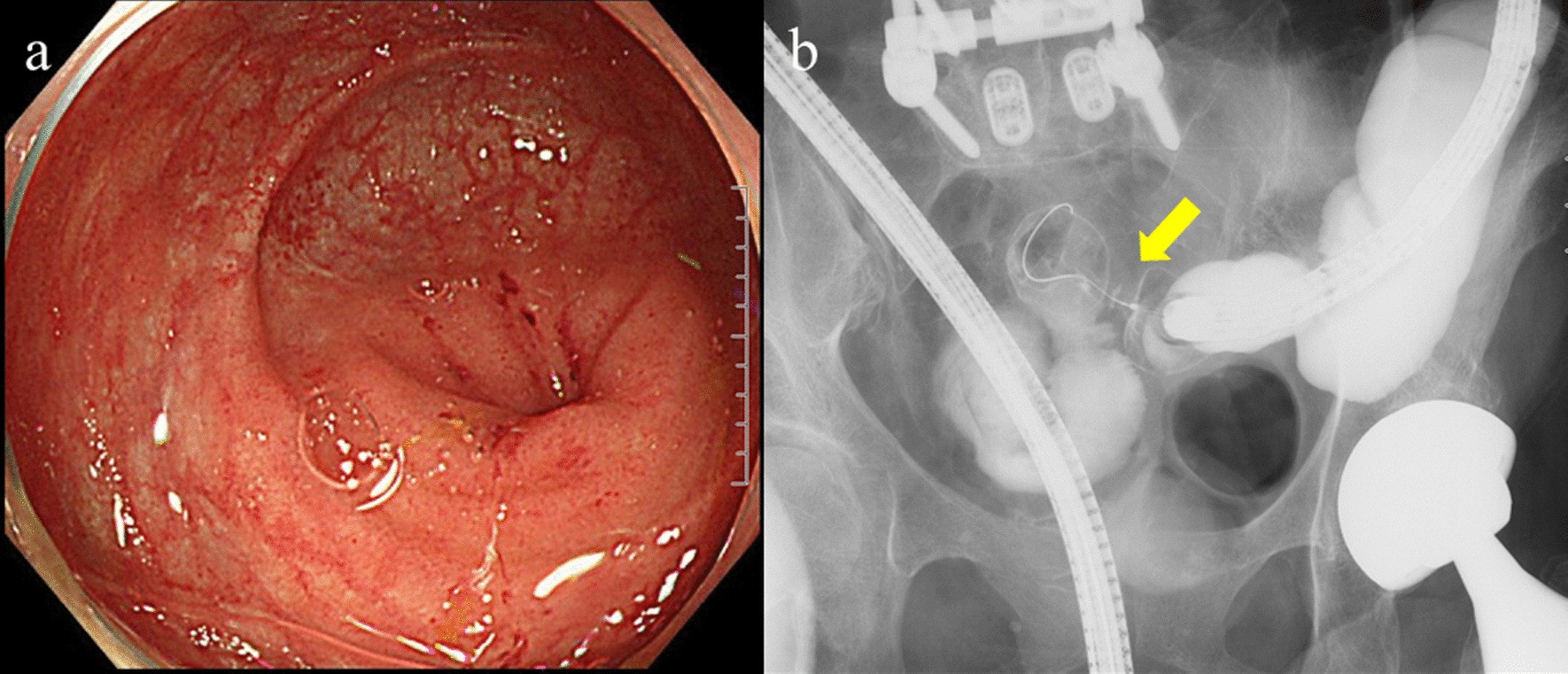 Fig. 2