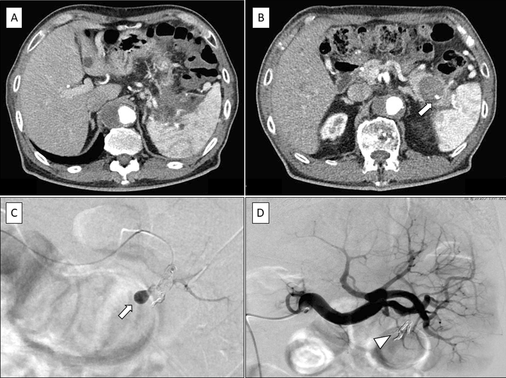 Fig. 2