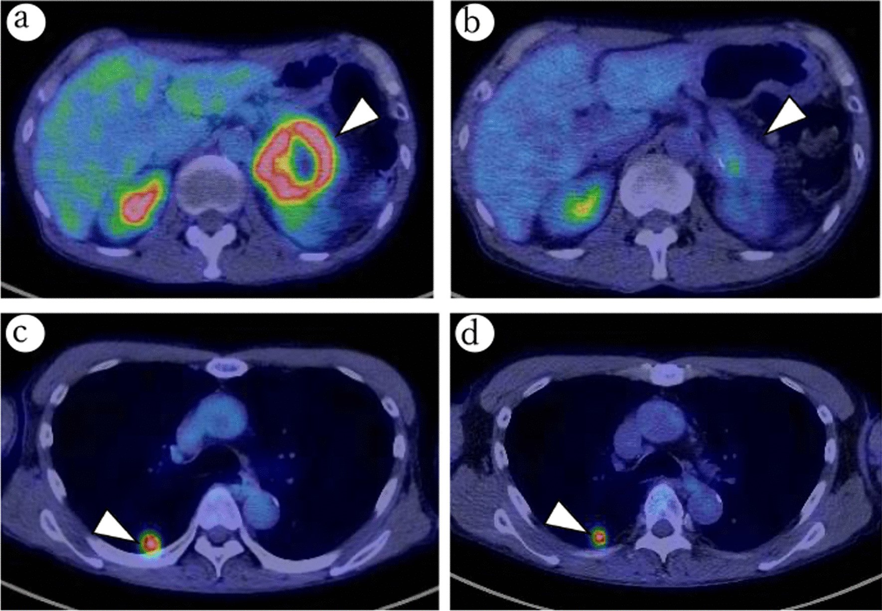 Fig. 2