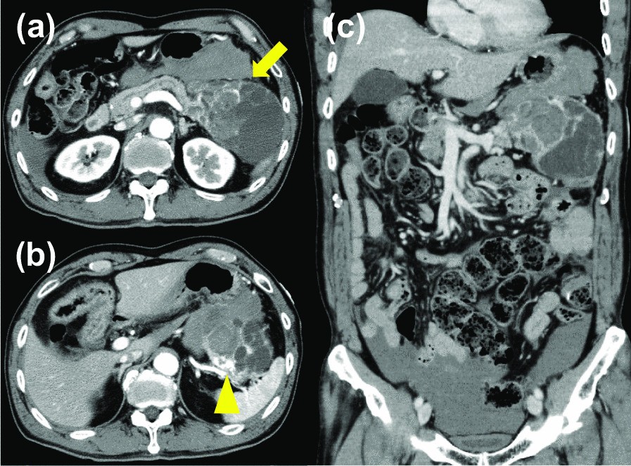 Fig. 1