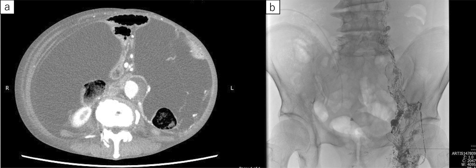 Fig.2