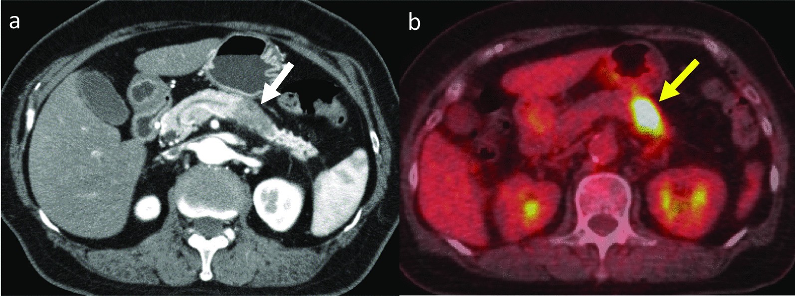 Fig. 1