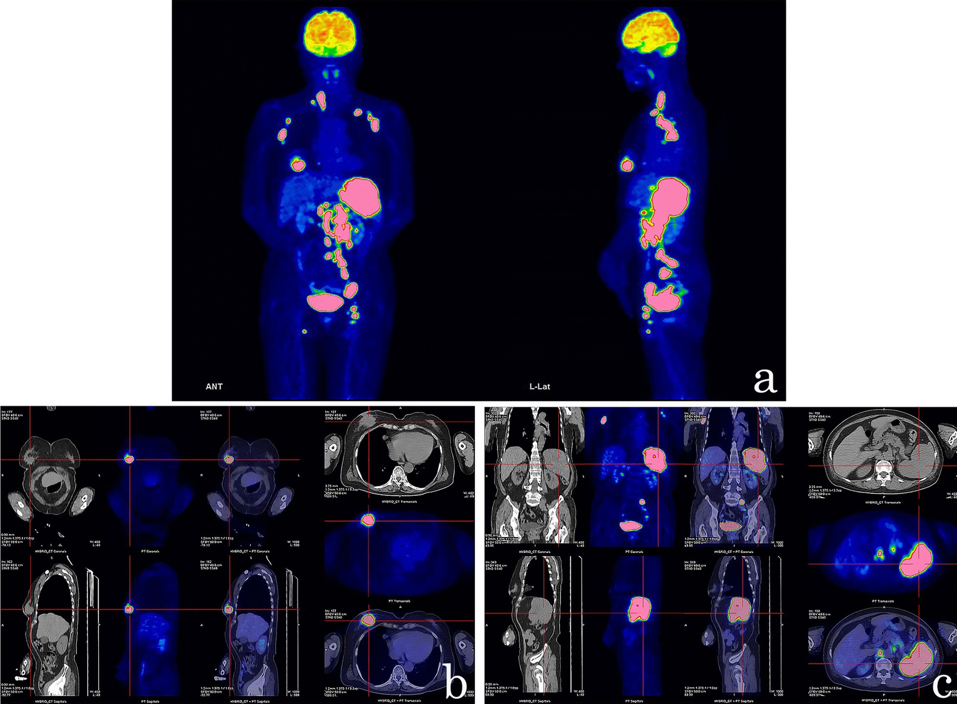 Fig. 3