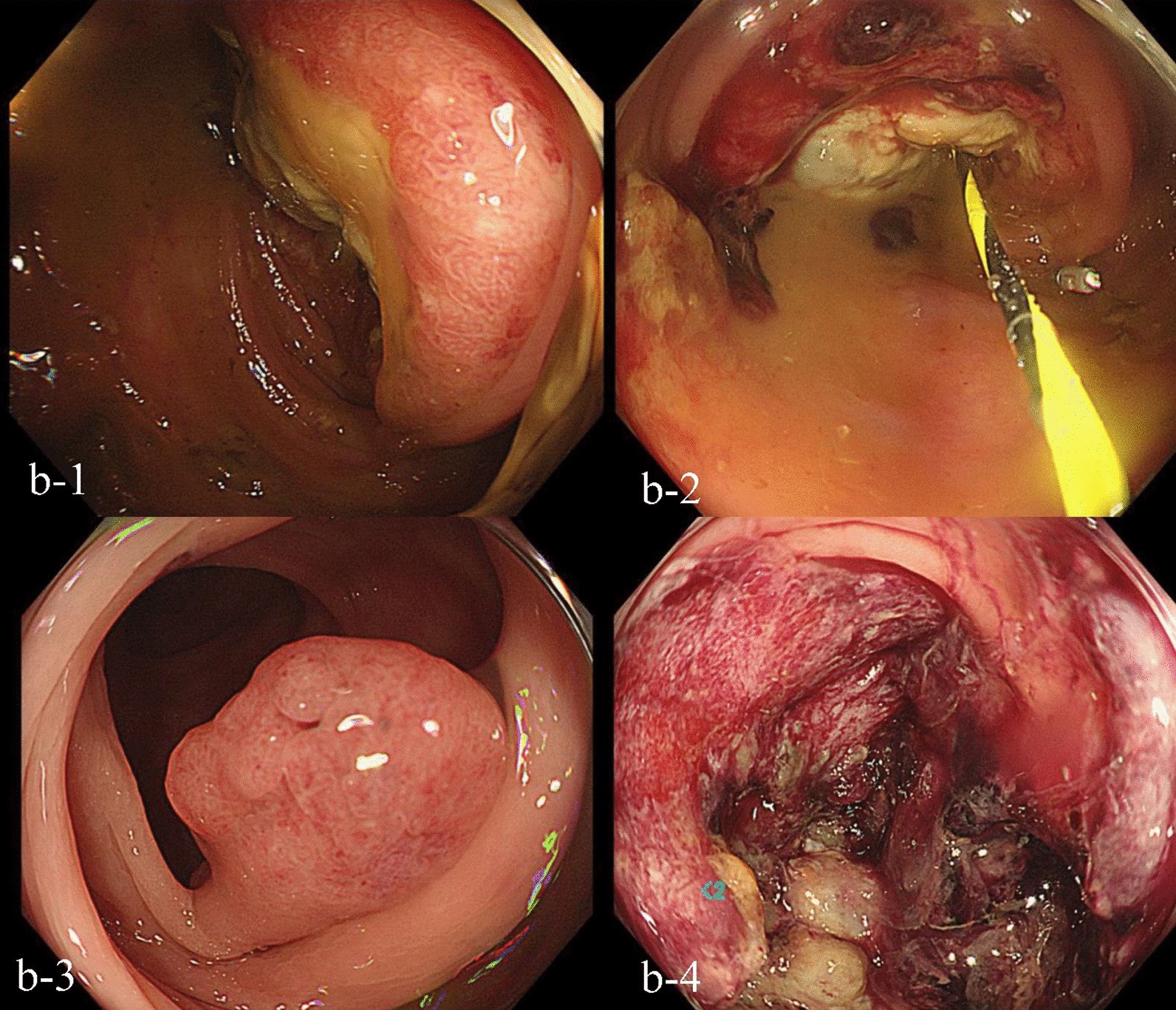 Fig. 2