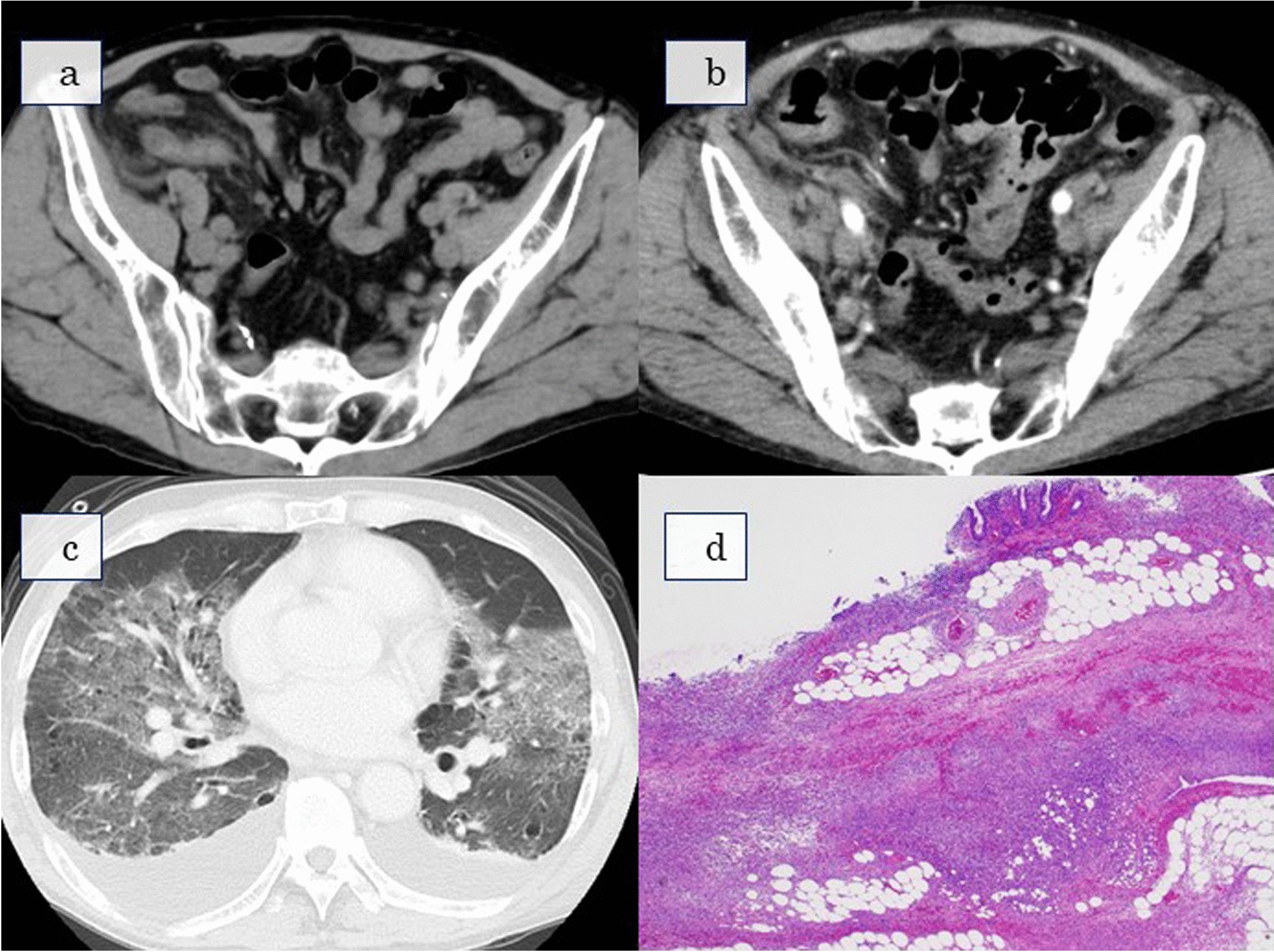 Fig. 1 a